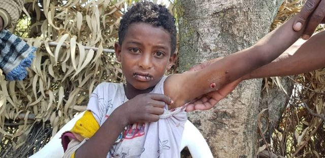 Ethiopian Army Accused of Drone Strikes Killing Four Civilians, Including Three-Year-Old Girl, in Amhara